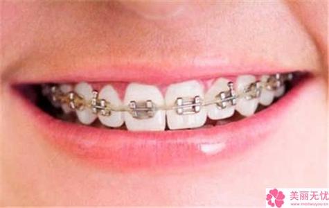 2023年南京市牙齿牙龈凹槽医院排名前十名新版出炉啦南京牙院长口腔好